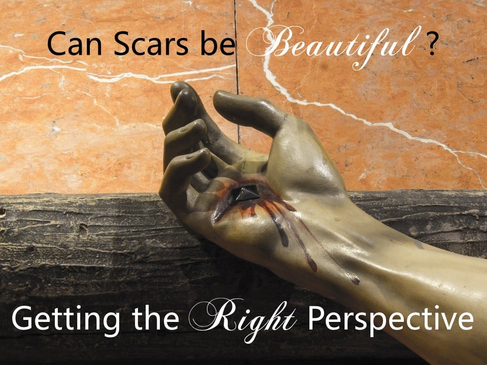 Read more about the article Can Scars be Beautiful? Getting the Right Perspective